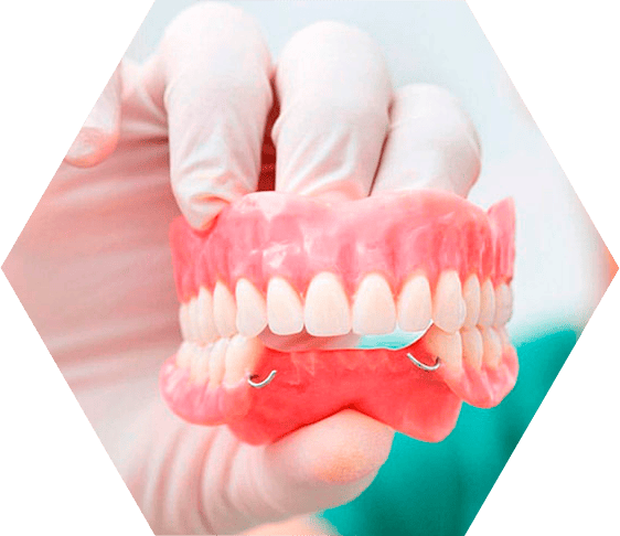 Протезирование