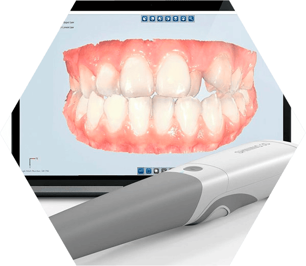 Цифровая стоматология